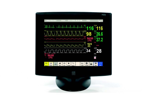 Patient Monitor