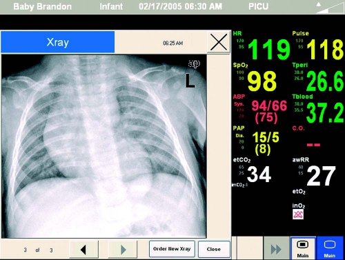 Screen Shot Xray