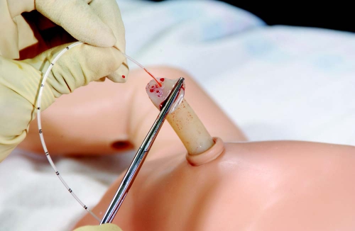 SimNewB_Umbilical