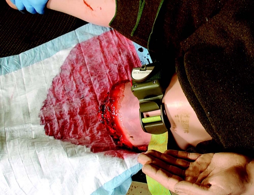Bleeding